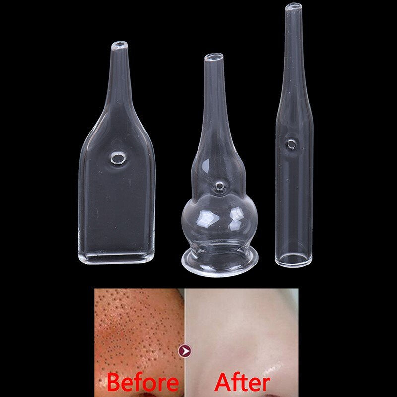 "Revitalize Your Skin with 7Style Blackhead Removal Glass Pipes - Experience the Ultimate Facial Care with Vacuum Suction and Beauty Machine"